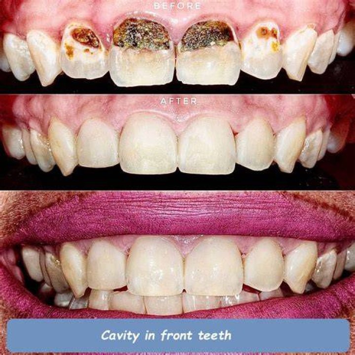 Can I get a loan to fix my teeth?