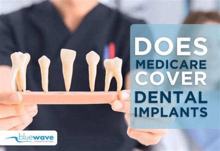 Do Medicaid pay for dental for adults?