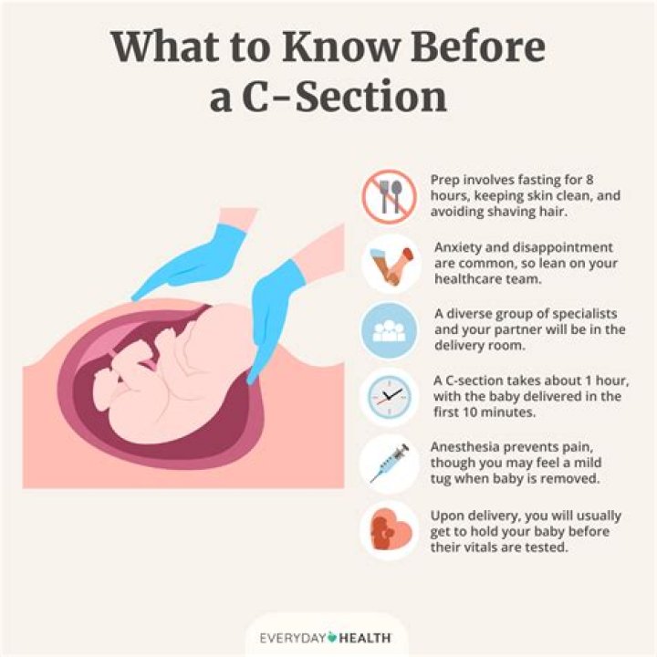 Does C-section affect second pregnancy?
