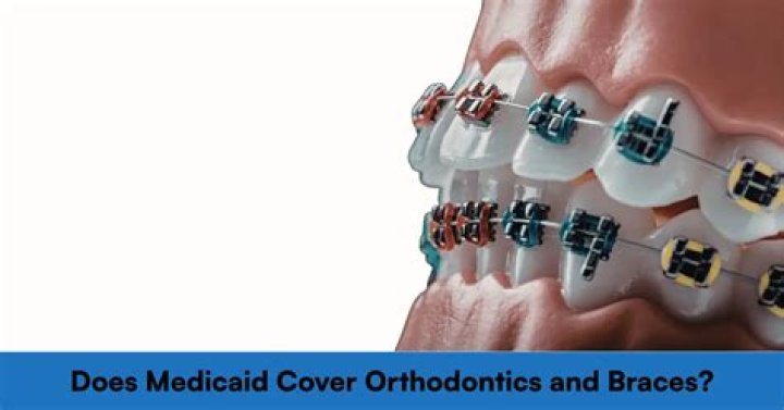 Does Mo Medicaid cover braces?