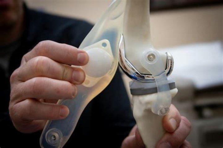 Does social security cover knee replacement?