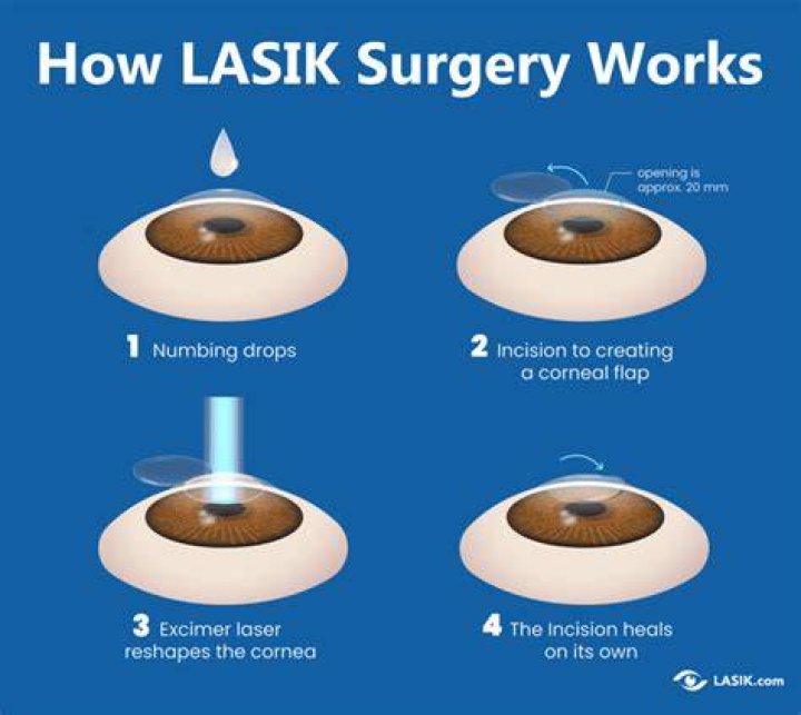 How can I get LASIK cheaper?