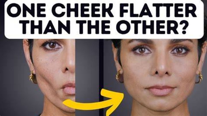 How can I make my cheeks fatter?