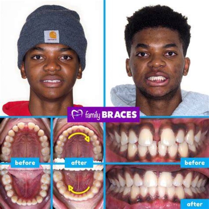 How long do orthodontists have to keep records?