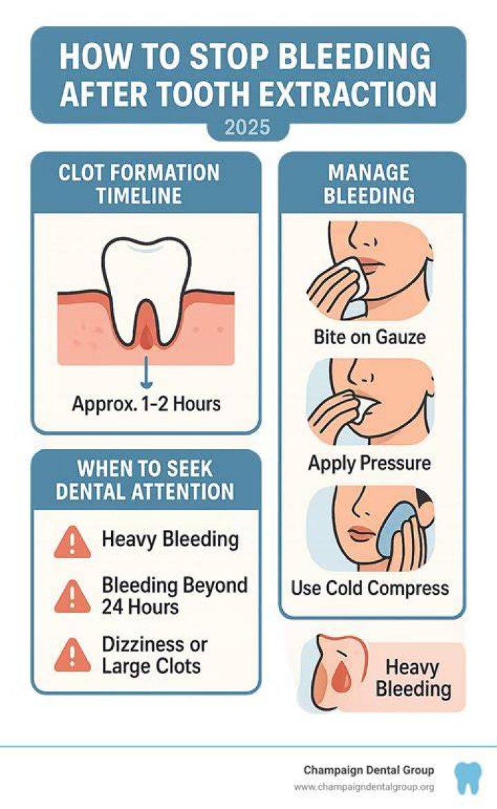 How long does it take for bleeding to stop after dental surgery?