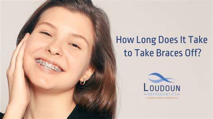 How long does it take to get your braces approved?