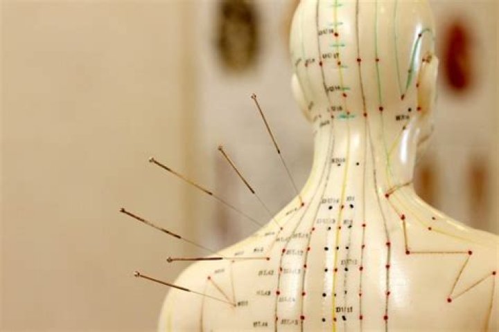 How much do Acupuncture make a year?