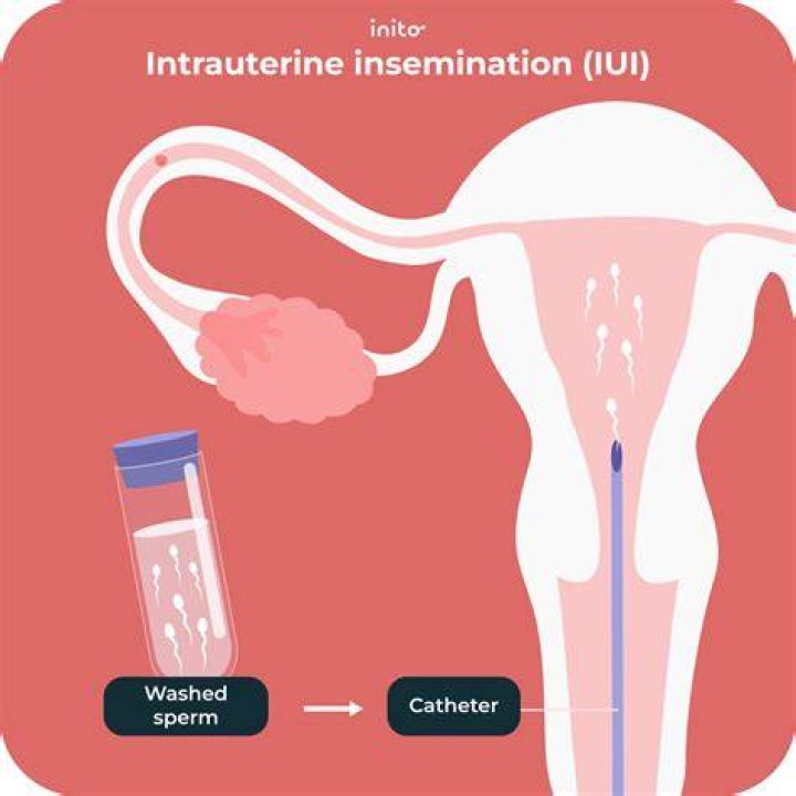 How much does a Artificial Insemination make?