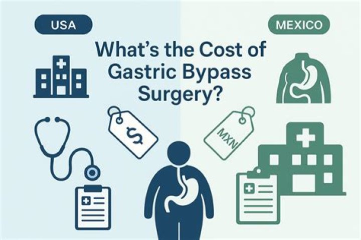 How much does gastric bypass surgery cost in Georgia?
