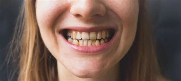 Is it too late to fix my teeth?