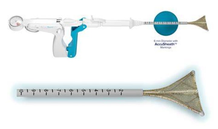 Who qualifies for endometrial ablation?
